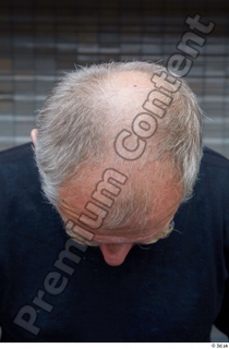 Street  659 bald hair head 0001.jpg
